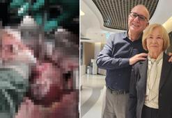 Yıllarca ameliyattan kaçtı, ölümden cerrahın parmakları ile kurtuldu