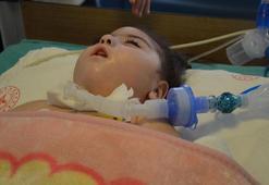3 yaşındaki depremzede Asiye, tedavisinin sürdüğü Eskişehir’de ameliyat oldu