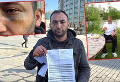 Kağıthane’de sevgilisinin evinde dehşeti yaşadı; tuzağa düşürülüp önce darp sonra gasbedildi