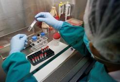 ABD’de tüberküloz vakalarında artış sürüyor