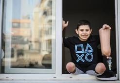 Bacakları kesilen Aras'ın protez borcuna icra işlemi