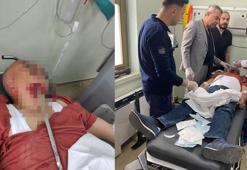 Şantiyede ayağı kayıp düşen işçinin yüzüne inşaat demiri saplandı