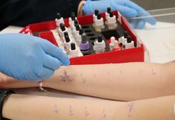 'Alerjik rinitin astıma ilerleme riski nedeniyle erken tanı ve tedavi önemli'