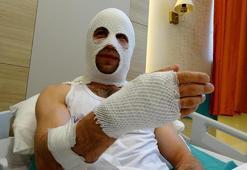 Nişanlısına hediye paketi hazırlarken patlayan sprey boya kutusu hastanelik etti