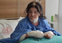 Amerikalı Arias'ın 20 yıldır kullanamadığı parmakları Eskişehir'deki operasyonla açıldı