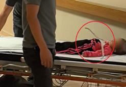 2 yaşındaki Meryem’in oynadığı askı çenesine saplandı