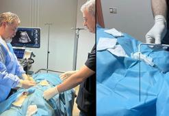 Ameliyatla alınamayan tümörler dondurularak yok ediliyor