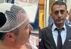 YRP'li İl Başkan Yardımcısı, Belediye Başkan Yardımcısı’nı şekerlikle başına vurarak yaraladı