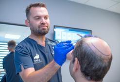 'Saç dökülmesi ilerlediyse, ilaçlar etkili olmaz'