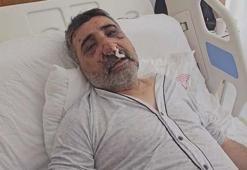 İngiliz boksörün darbettiği taksici konuştu