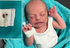 Muhammed bebeğin yemek borusuna takılan badem şekeri, operasyonla çıkarıldı