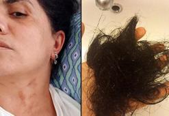 Bebek sahibi olamadığı için eşinden şiddet gördüğü gerekçesiyle boşanma davası açtı