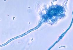 Ölümcül mantar hastalığı, küresel ısınmayla yayılabilir