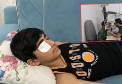 Yapıştırıcı sıçrayınca kapanan göz kapağı doktor müdahalesiyle açıldı