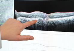 ‘Erken teşhisle görme kaybının önüne geçmek mümkün’