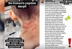 Rehabilitasyon merkezinde 5 yaşında çocuğa darp iddiasına soruşturma