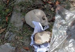 Çöpte bulunan kafatasını, uzman doktorun temizlik yapan eşi atmış