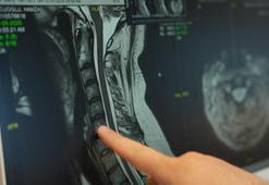 ‘Teknolojik cihazların yoğun kullanımı ‘tekno boyun’ problemine yol açıyor’