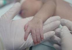 Geçen yıl 31 bin 109 anne, çoğul doğum yaptı