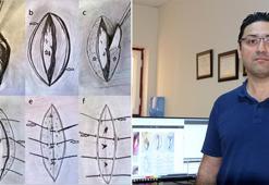 Kıl dönmesine estetik ve kalıcı müdahale