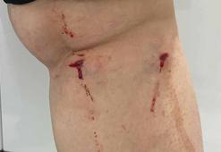 Üniversite kampüsünde köpeklerin saldırısına uğradı: O anlar kamerada