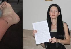 Solaryum cihazında unutulan Gülşah’tan mahkeme kararına tepki: Sağlık bu kadar ucuz olmamalı