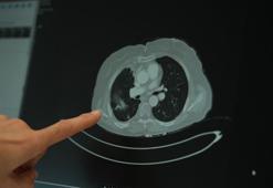 ‘Genç yaş grubunda kanser vakalarında artış yaşanıyor’