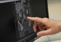 ‘Dengeli bir diyet birçok fizyolojik mekanizmayı doğrudan etkiliyor’