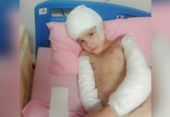 Sokak köpeklerinin saldırdığı Tunahan'ın davasında beraat gerekçesi; Kastla hareket ettiklerine dair delil yok