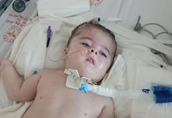 25 ayda 16 ameliyat geçiren hidrosefali hastası Ayaz, yaşam mücadelesi veriyor