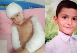 Sokak köpeklerinin saldırdığı Tunahan'ın davasında sanıkların beraatine savcılıktan itiraz