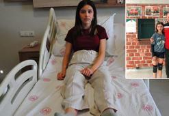 Voleybolcu Zeynep, yapay deri ameliyatıyla sağlığına kavuştu