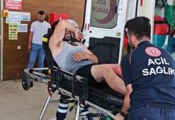 Tamir ettiği otomobilin radyatöründen sıçrayan kaynar suyla yaralandı