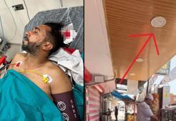 Döner yerken başına kurşun isabet etti