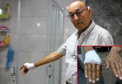 Duşa kabin camı patladı, emekli akademisyen yaralandı
