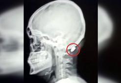 'Silah sesi duyduğunuzda balkona pencereye koşmayın, gizlenin'