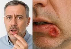 Sigara ve alkol kullanımında 'kanser' tehlikesi