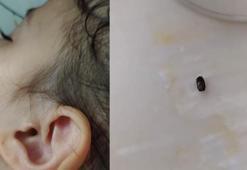 İzmit’te parkta 3 yaşındaki çocuğun kulağına kene yapıştı