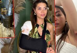 Avcılar'da tamirhane önündeki motor yağı nedeniyle kayıp yaralandı; dava açtı