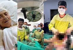 Hastanın karaciğerinden 90 santimetrelik kedi-köpek kisti çıkarıldı