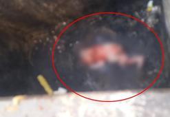 Doğurup çöp konteynerine attığı bebeği esnaf fark etti; anne gözaltında