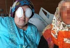 Şizofreni hastası kadın, 5 yıl sonra başka bir hastanın daha gözlerini oydu