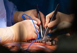 Ölü kalp yeniden çalıştırıldı
