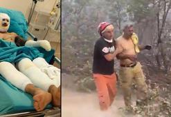 Orman yangınına müdahale sırasında ağır yaralanan eşinin son halini paylaştı
