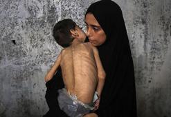 Gazze'de son 24 saatte 2'si çocuk 6 kişi açlıktan yaşamını yitirdi