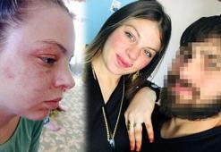 Kendisini darbeden milli sporcu eşinden şikayetçi oldu