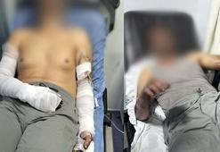 Oto tamirhanesinde patlama; 2 işçi yaralandı