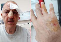 Evden tahliyesi sırasında kendisini darbettiğini öne sürdüğü kayınbiraderinden şikayetçi oldu