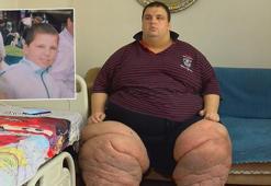 270 kilo Mehmet: 15 aydır evden çıkamıyorum, yardım edin