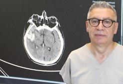 'Gençlerde beyin kanaması görülme oranı giderek artıyor'